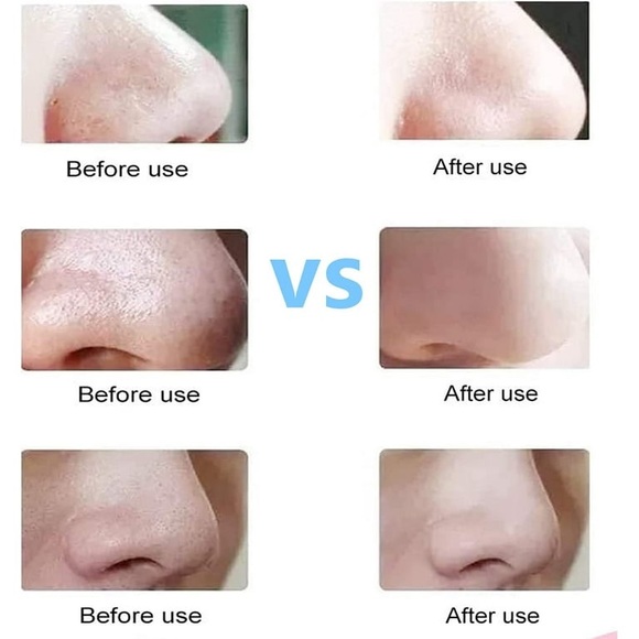 TWEEZERMAN No-Slip Skin Care Tool ~NIB NWT IN PACKAGING - Picture 9 of 9